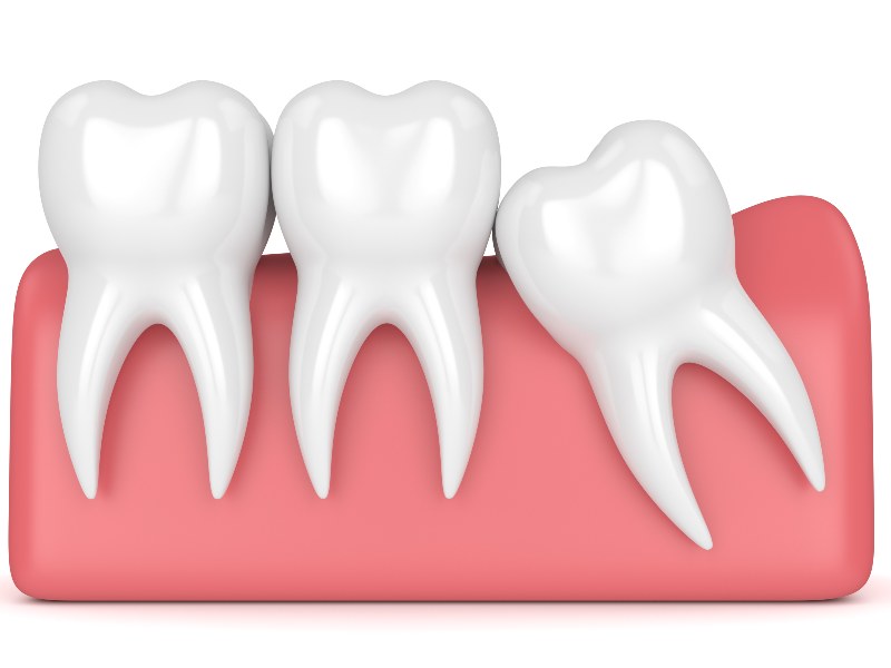 601842d859b02931c63848dd Extraction Service Img