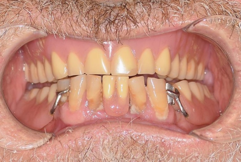 64c1a10818dafb87d34bf535 Case 8 Before