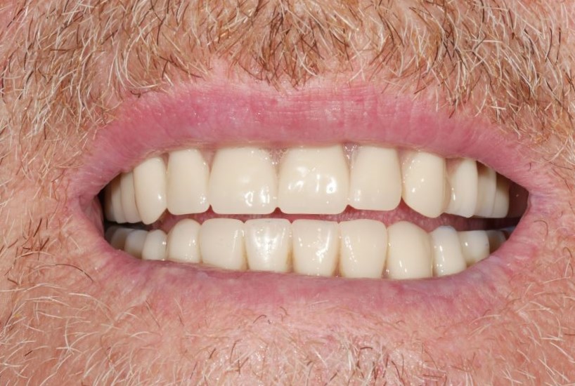 64c1a124e0ba338f23577828 Case 8 After