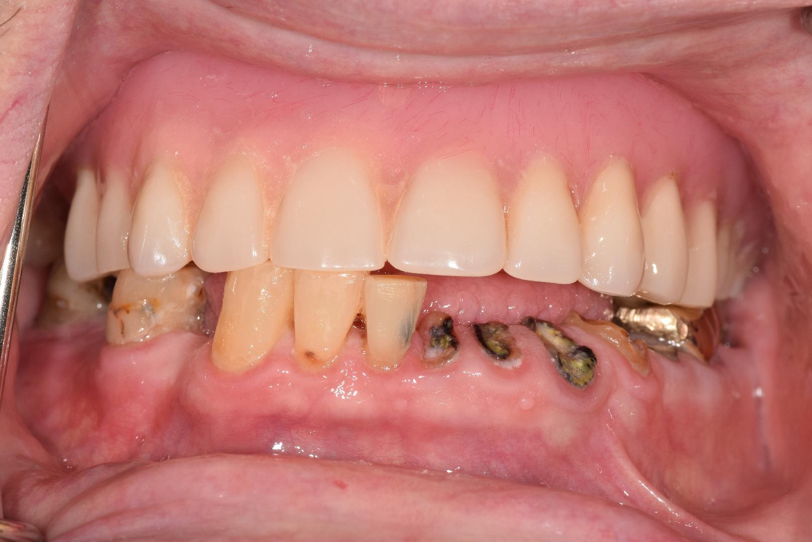 64c1a19e32cc144f09ff4ee8 Case 4 Before