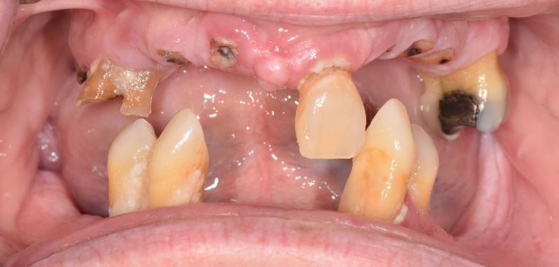 64c1a23c08d695c5960df216 Case 12 Before