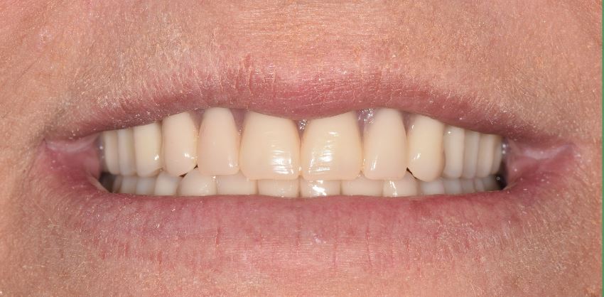 64c1a24502cd07609db9ee74 Case 12 After