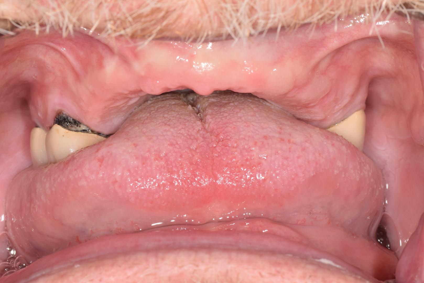 64c1a26963f847c5364acac2 Case 3 Before